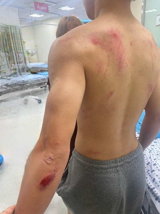 Photo taken by the father of a 16 year-old who was taken down by police after reports were made against the middle school student, who was running late at night with a hood on. [SCREEN CAPTURE]
