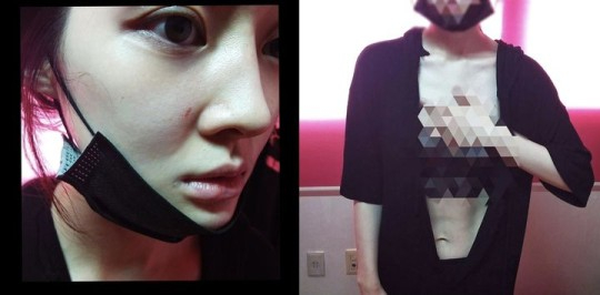 Lee uploaded photos showing her face and ripped clothes to Instagram account on Monday, naming her husband as the assailant. [SCREEN CAPTURE]