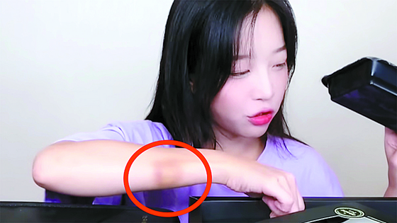YouTuber Tzuyang with a bruise on her right arm [SCREEN CAPTURE]