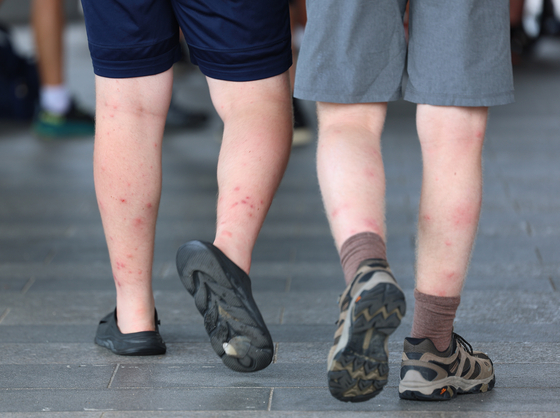Jamboree scouts return to accommodation with bugbite-ridden legs on Aug. 6, 2023. [YONHAP] 