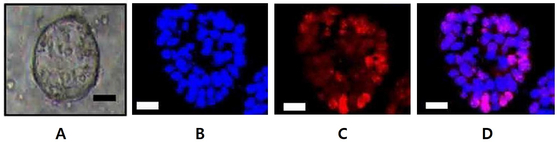 A precancerous head and neck organoid model developed by the research team of Yonsei University’s Gangnam Severance Hospital and the University of Southern California [JOONGANG ILBO]