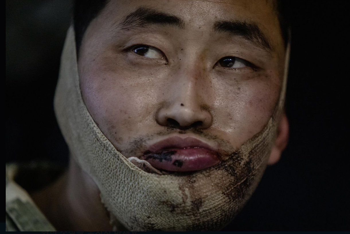 A wounded soldier, suspected to be North Korean and captured by Ukrainian forces in Russia's western Kursk region, is seen in this file photo posted on Ukrainian President Volodymyr Zelenskyy's X account on Jan. 11. [YONHAP]