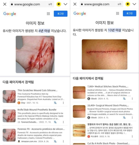 Gold Medalist confirmed with screenshots that the evidence photographs revealed by Hoverlab of the informant’s scars from being physically attacked at the request of Gold Medalist were fake and that they were downloaded from Google. [GOLD MEDALIST]