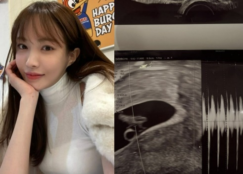 Seo Eun-woo, also known as Seo Min-jae, and an ultrasound posted on Seo's Instagram account. [SCREEN CAPTURE]