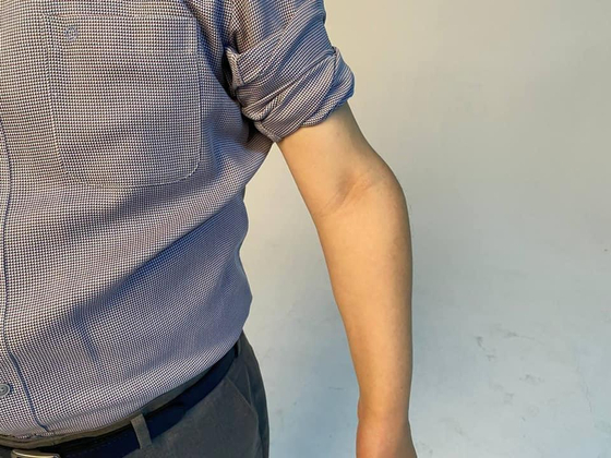 Lee Jae-myung's left arm was injured while working at a factory when he was young. The picture was released in 2021 on Lee's Facebook page. [SCREEN CAPTURE] 