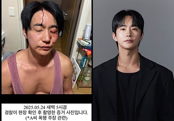 Left: A picture uploaded by actor Jeon Ho-jun on May 25 of himself bleeding after allegedly being assaulted by his former partner on May 23, on Instagram [SCREEN CAPTURE]