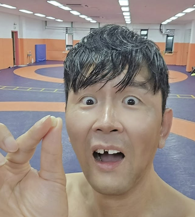 Yoon Hyung-bin, comedian turned MMA fighter, holds up a broken tooth. [KIM SEONG-RYONG]