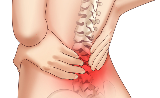 Illustration of back pain [JOONGANG ILBO]