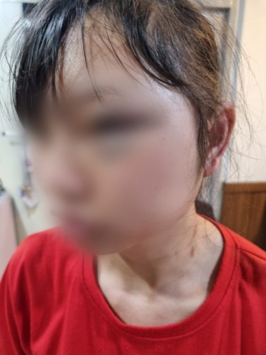 The female migrant worker that was assaulted by a man in his 40s while working at a company in Yongin, Gyeonggi [YONHAP]
