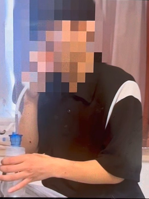 An image revealed on Telegram believed to show a university student from North Gyeongsang who died after being tortured by a criminal organization in Cambodia. [SCREEN CAPTURE]