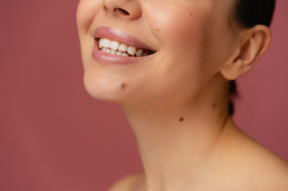 A close-up of a woman’s moles, a feature often interpreted with specific meanings in Korean physiognomy. [GETTY IMAGES BANK]