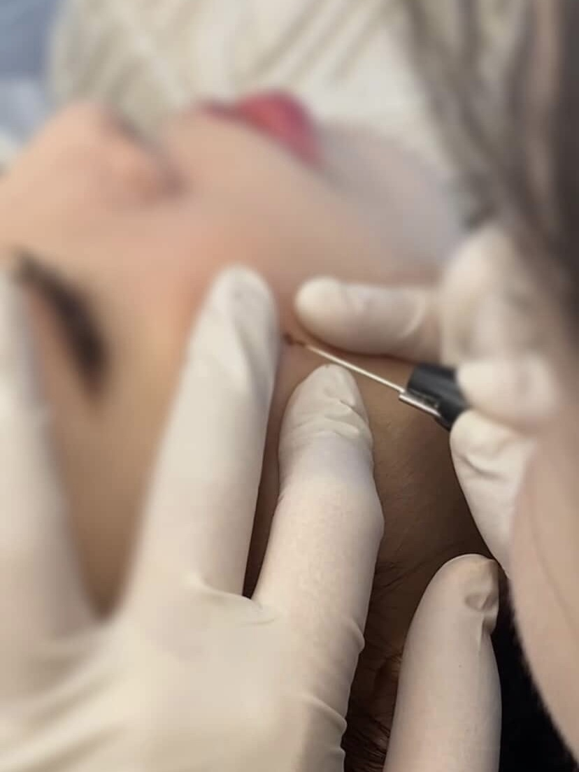 Tattooist Park Ja-young places a semi-permanent beauty mark on a client’s face — a rising trend among young Koreans seeking aesthetic or “lucky” mole placements. [COURTESY OF PARK JA-YOUNG]